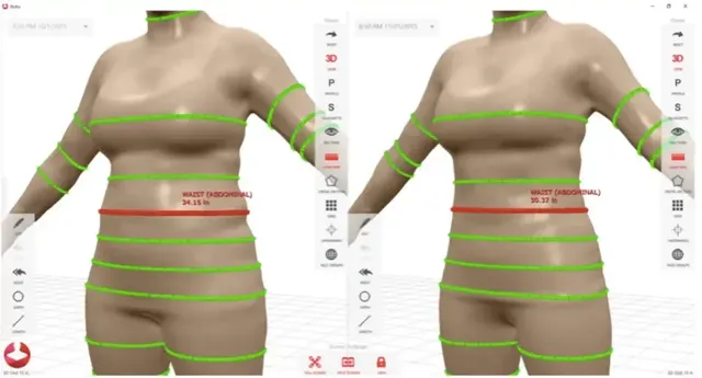 weight+loss+treatment